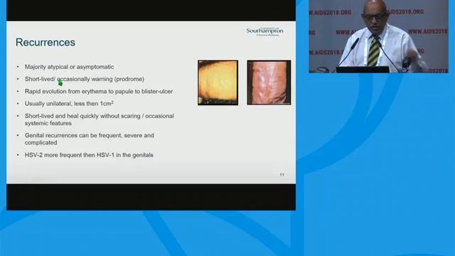 Herpex simplex virus смотреть онлайн