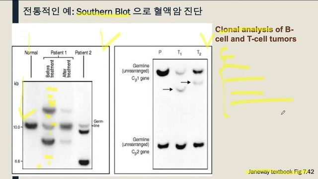 B세포 수용체(BCR)와 T세포 수용체(TCR)의 단일세포(single cell) 수준에서의 정량과 이를 이용한 진단, 그리고 환자 맞춤 의학에의 적용을 정리합니다. смотреть онлайн