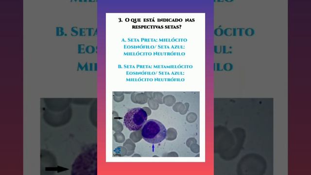 MEGA QUIZ - HEMATOLOGIA смотреть онлайн
