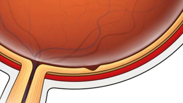 The TEMPO method: Tracing Expression of Multiple Protein Origins смотреть онлайн