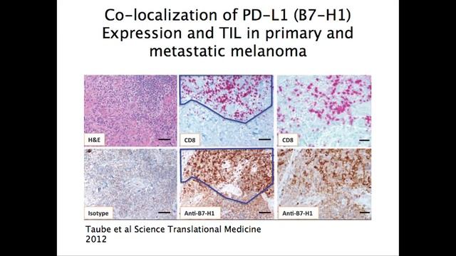 Immunotherapy - PD-1 and Beyond - Melanoma Education Symposium, Patrick Ott MD PhD смотреть онлайн
