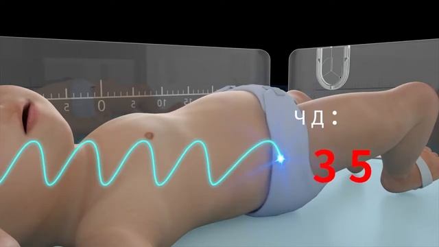 【COMEN】Реанимационная открытая система для новорожденных - BQ80 смотреть онлайн