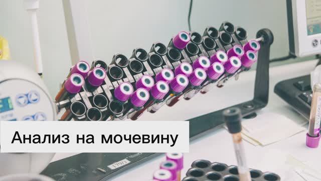 Анализ на мочевину