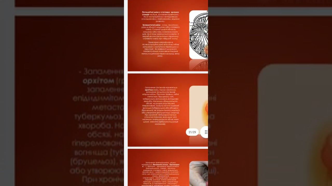 пат.анатомия смотреть онлайн