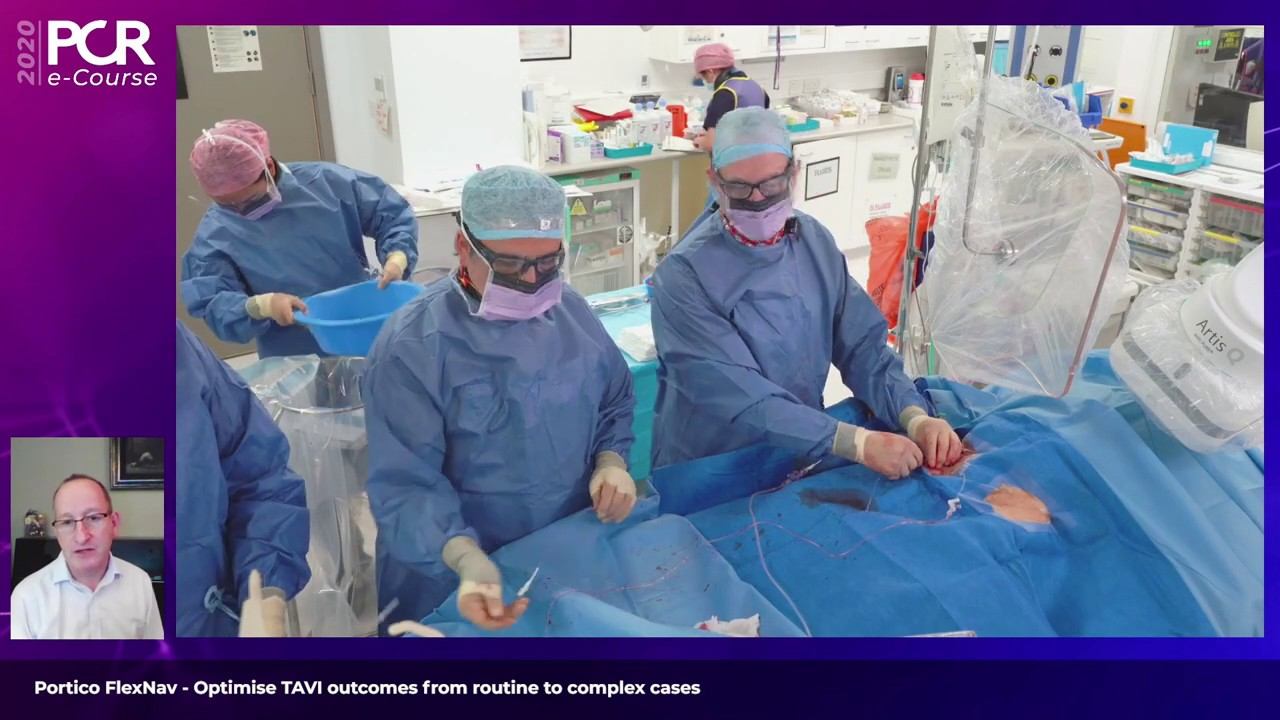 Portico FlexNav - Optimise TAVI outcomes from routine to complex cases - PCR e-Course 2020 смотреть онлайн
