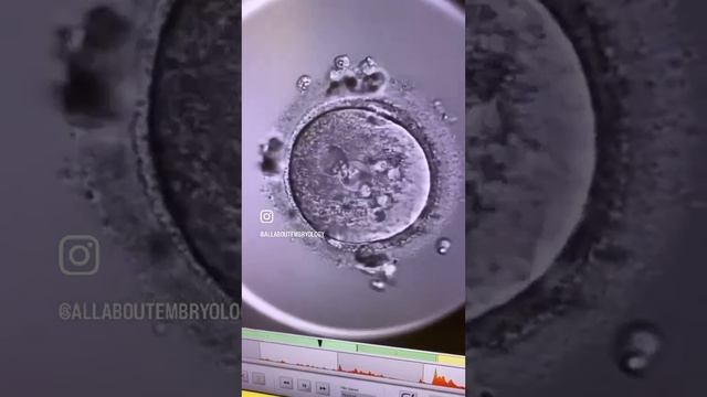 ABNORMALITIES IN THE HUMAN OOCYTE AND EARLY ENBRYO #science #embryologist #fertilitytreatment #ivf смотреть онлайн