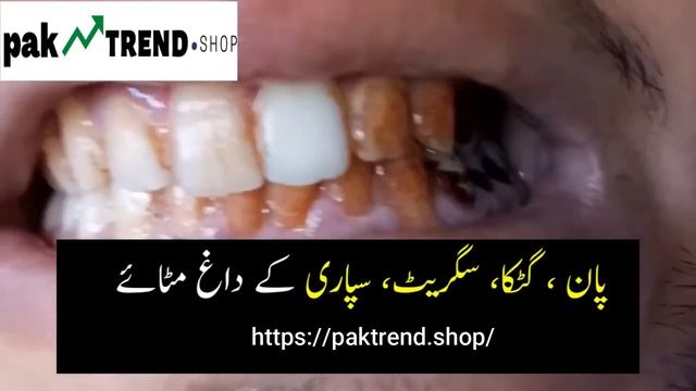 Teeth Whitening Essence смотреть онлайн