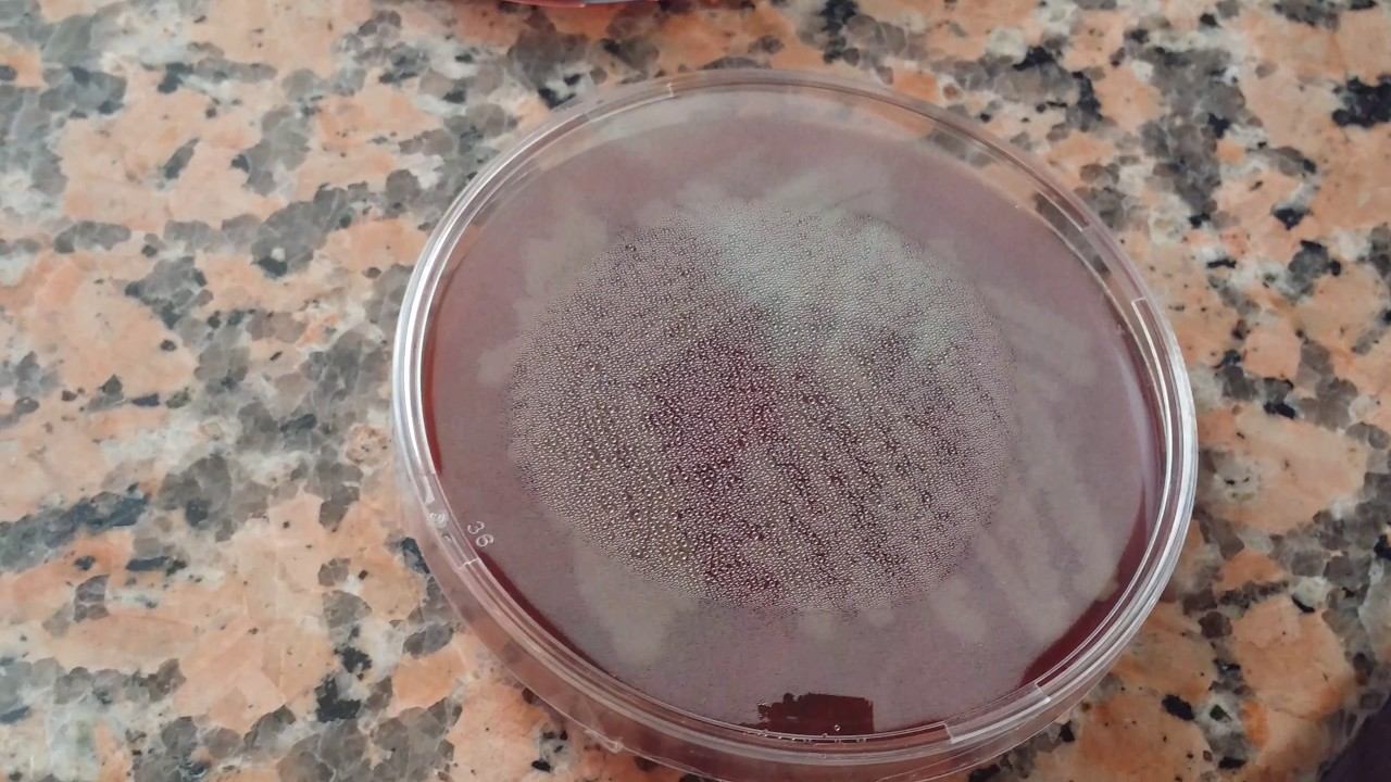 Bacillus subtilis on the blood agar смотреть онлайн