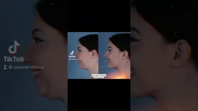 How to enhance chin? смотреть онлайн