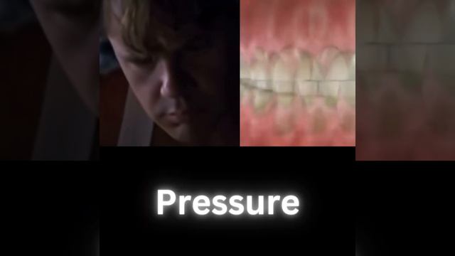 BRUXISM (explained by Morgan Freeman) смотреть онлайн