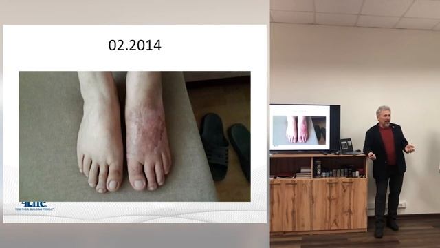 Истории приема трансфер факторов от кандидата медицинских наук, врача-инфекциониста Егорова А.И. смотреть онлайн