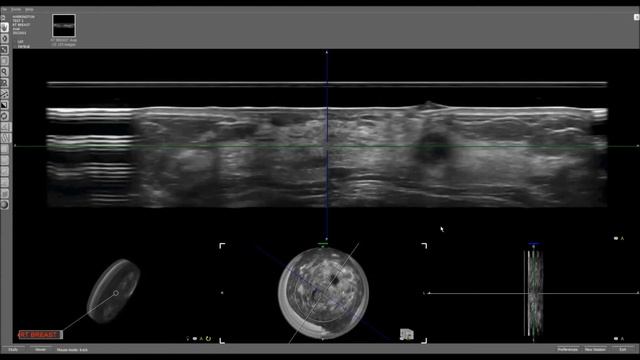 2015 HITACHI & iVu SOFIA 3D Automated Breast Sono Tomography 2015 model смотреть онлайн