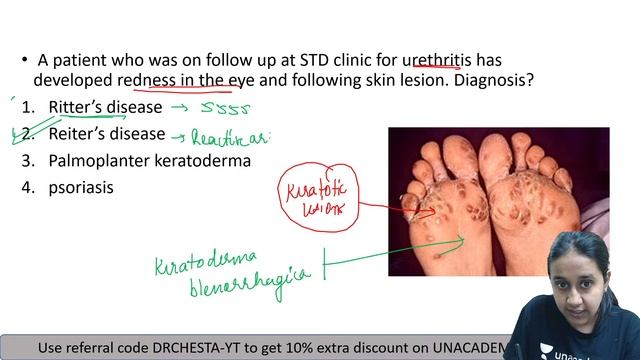 Must-Know Images- Dermatology | Dermatology | NEET PG 2021 | Let's Crack NEET PG | Dr.Chesta Agarwa смотреть онлайн