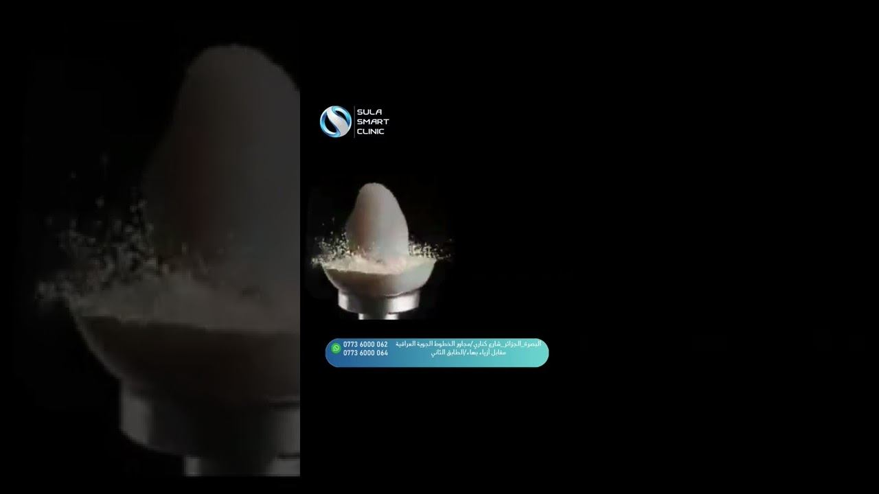 تخفيضات نار عل #تركيب_اسنان بأسرع وقت وانسب سعر #شيف_شاهين_دعم_صناع_المحتوى #تركيب_الزيركون #اكسبلو смотреть онлайн