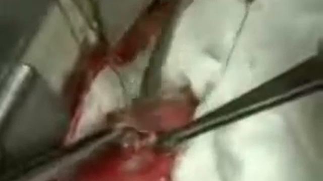 ПАРАЗИТ В СЕРДЦЕ!!! смотреть онлайн