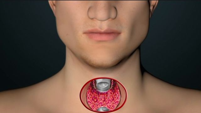 Parathyroid Surgery: Traditional Open and Minimally Invasive Approaches смотреть онлайн