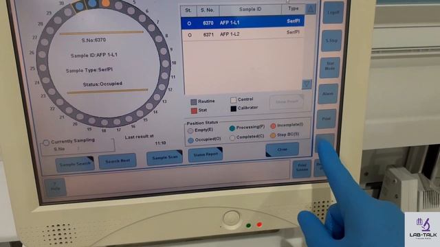 Practical lab explanation part 2(cobas e411 calibration & control)-طريقة عمل المعايرة والكنترول смотреть онлайн