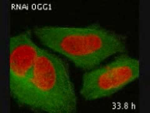 OGG1-silenced cells - mitosis goes haywire смотреть онлайн