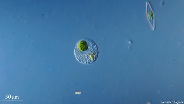Amoeba eats unicellular alga смотреть онлайн