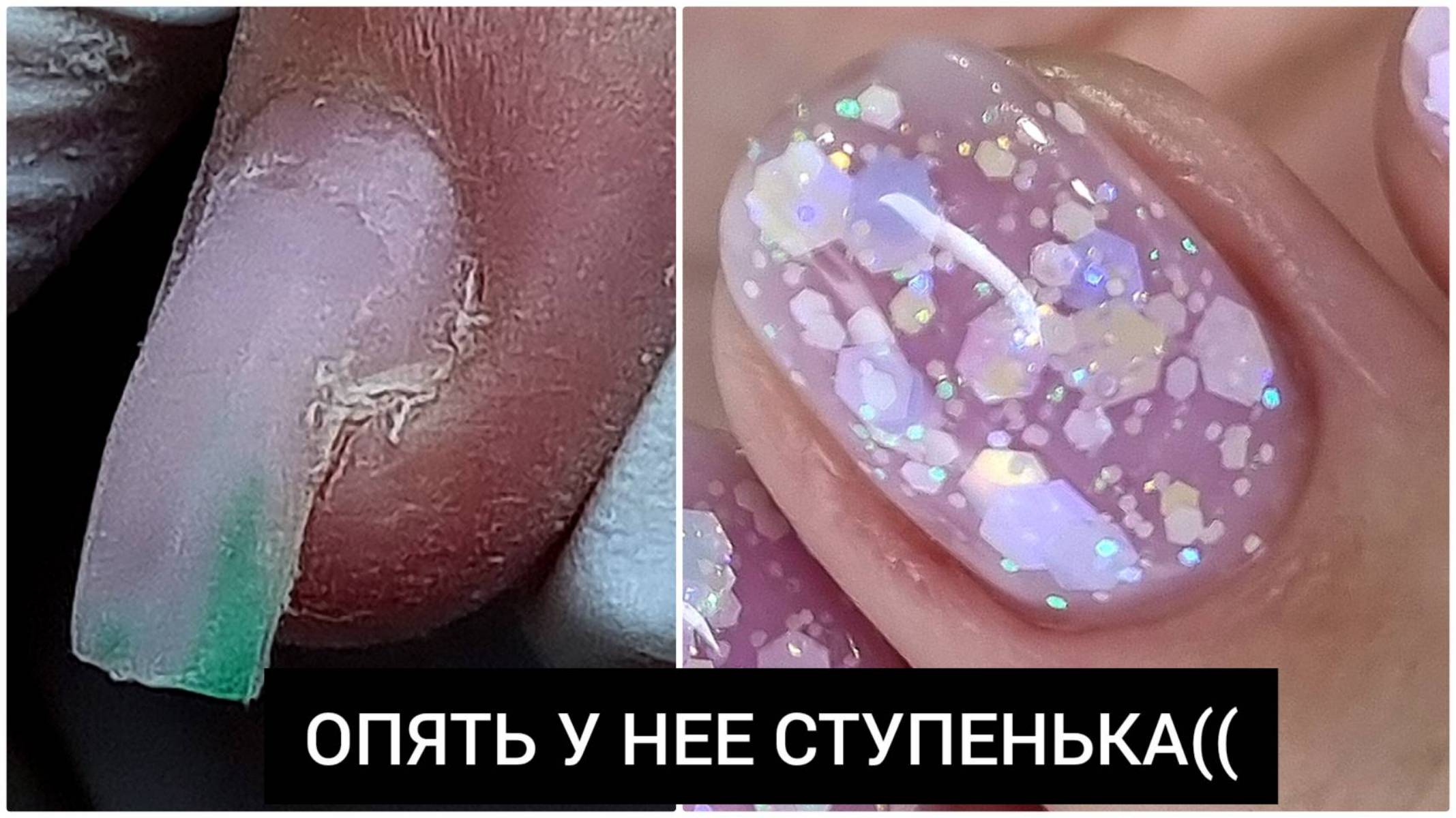 УЖАС!!! опять НЕТ половины НОГТЯ