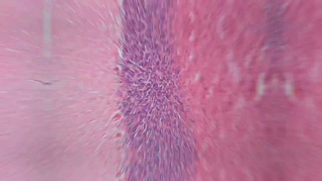 Гистологиялық препаратты талдау: Мишық смотреть онлайн