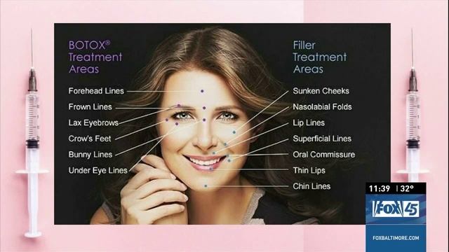 B'More Lifestyle Segment - Dr. Theda Kontis Describes Facial Fillers & Botox смотреть онлайн