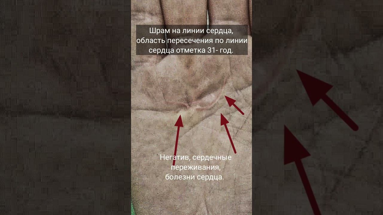Знак тюрьмы на ладони смотреть онлайн