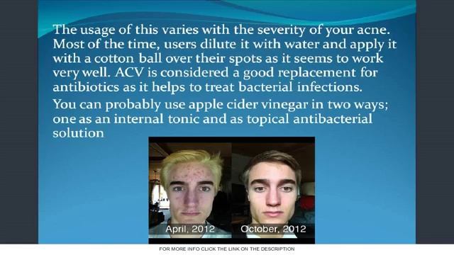 Monica Yearwood - Best Essential Oils for Acne - Monica Yearwood смотреть онлайн
