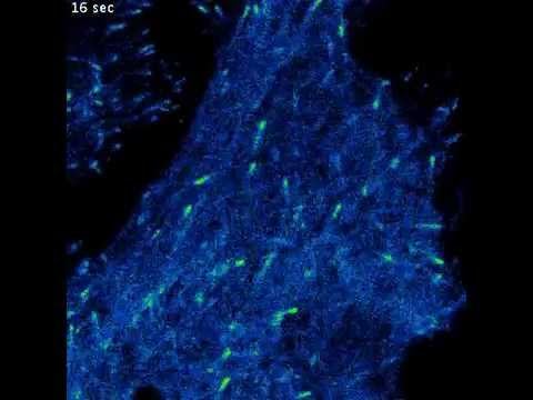 Microtubule Dynamics in a live Cancer Cell смотреть онлайн