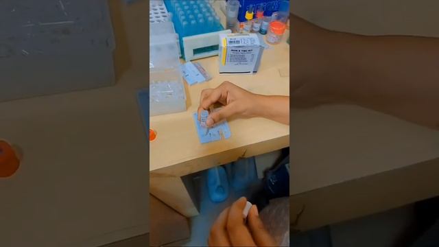 Viral marker Test | HIV | HCV |HBsAg #serology #laboratorytechnician смотреть онлайн