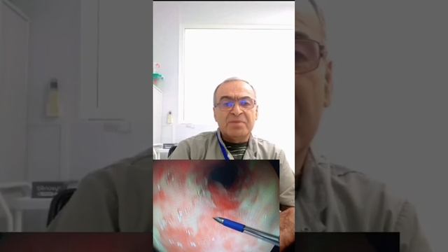 Гастроэзофагеальная рефлюксная болезнь (ГЭРБ) смотреть онлайн