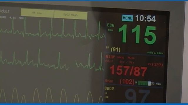 Bosnalijekova TV Ordinacija - Hipertenzija sa osvrtom na Bosnalijekovu paletu proizvoda - 24.11.201 смотреть онлайн