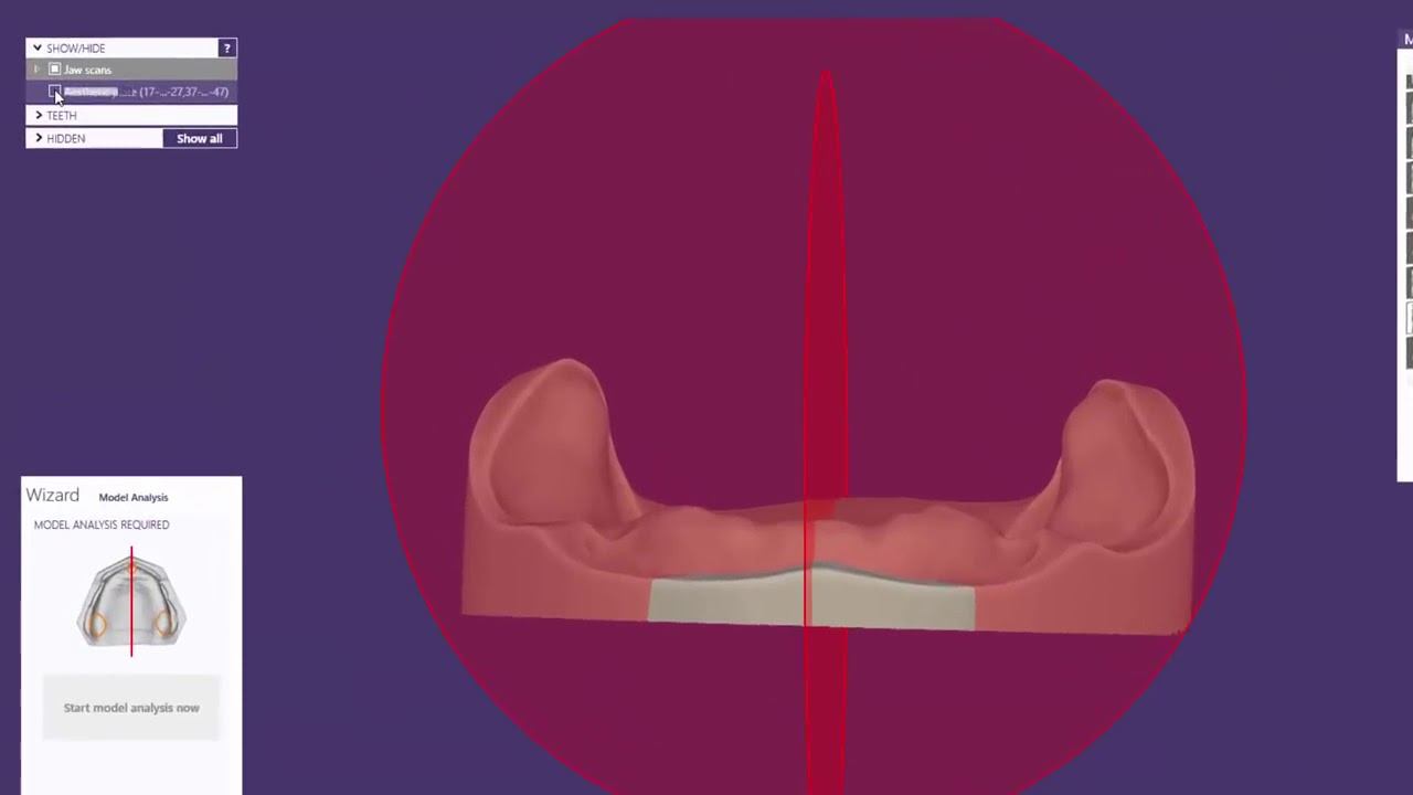 exocad Video Tutorial Full Denture Design смотреть онлайн