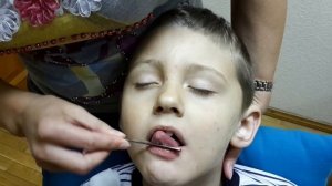 Логопедический массаж губ и языка для не говорящих детей.  Как делать в домашних условиях?