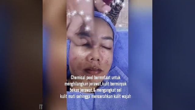 Mila derma beauty siwa смотреть онлайн