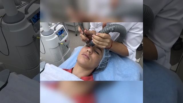 Лазерная блефаропластика Smooth Eye в Эстетик Клубе смотреть онлайн