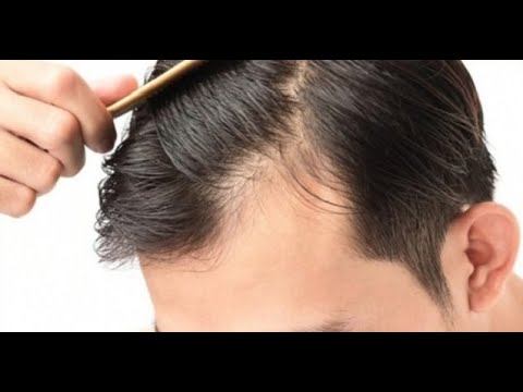 Homm Bitkisel SARIMSAKLI GİNSENG ŞAMPUAN / Detaylı Anlatım - Saç Dökülmesine Karşı смотреть онлайн