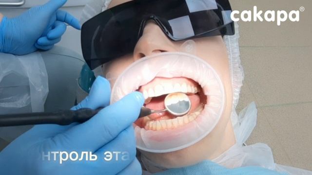 Процедура выполнения профессиональной гигиены полости рта в САКАРА смотреть онлайн