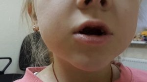 Как поставить звук Ч правильно? Проверенный и быстрый способ при дизартрии