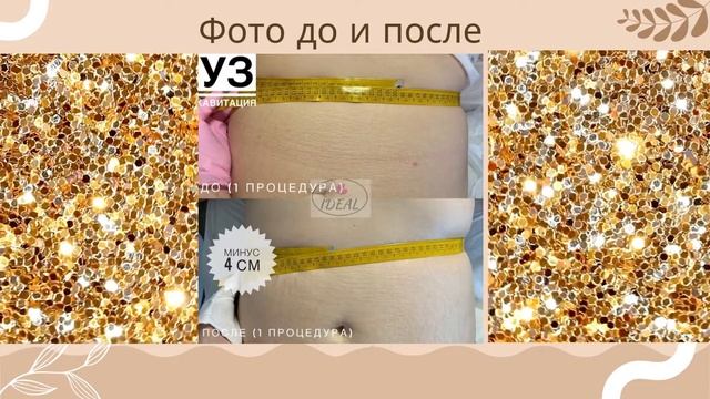 Отзыв№7 кавитация смотреть онлайн