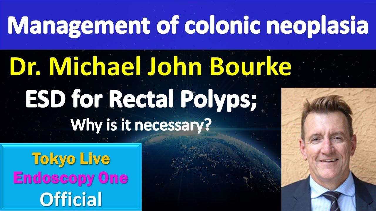 Management of colonic neoplasia② Dr Michael Bourke смотреть онлайн