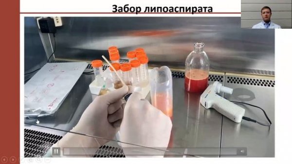 Набор SmartX для получения SVF.