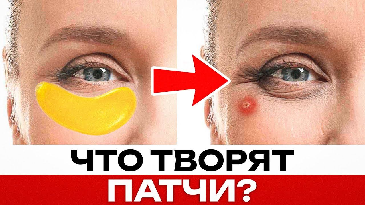 Патчи для глаз ПОРТЯТ КОЖУ? / Факты о патчах, которые ВАЖНО ЗНАТЬ! смотреть онлайн