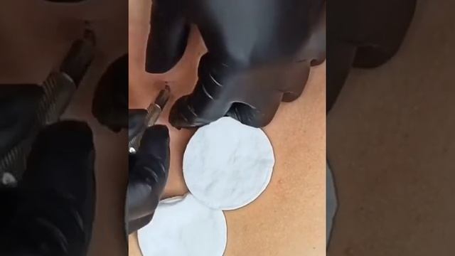 Установка микродермала смотреть онлайн