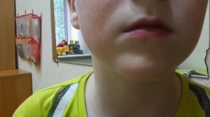 Дизартрия. Нарушения речи. Работа с дизартрией на занятии у логопеда.