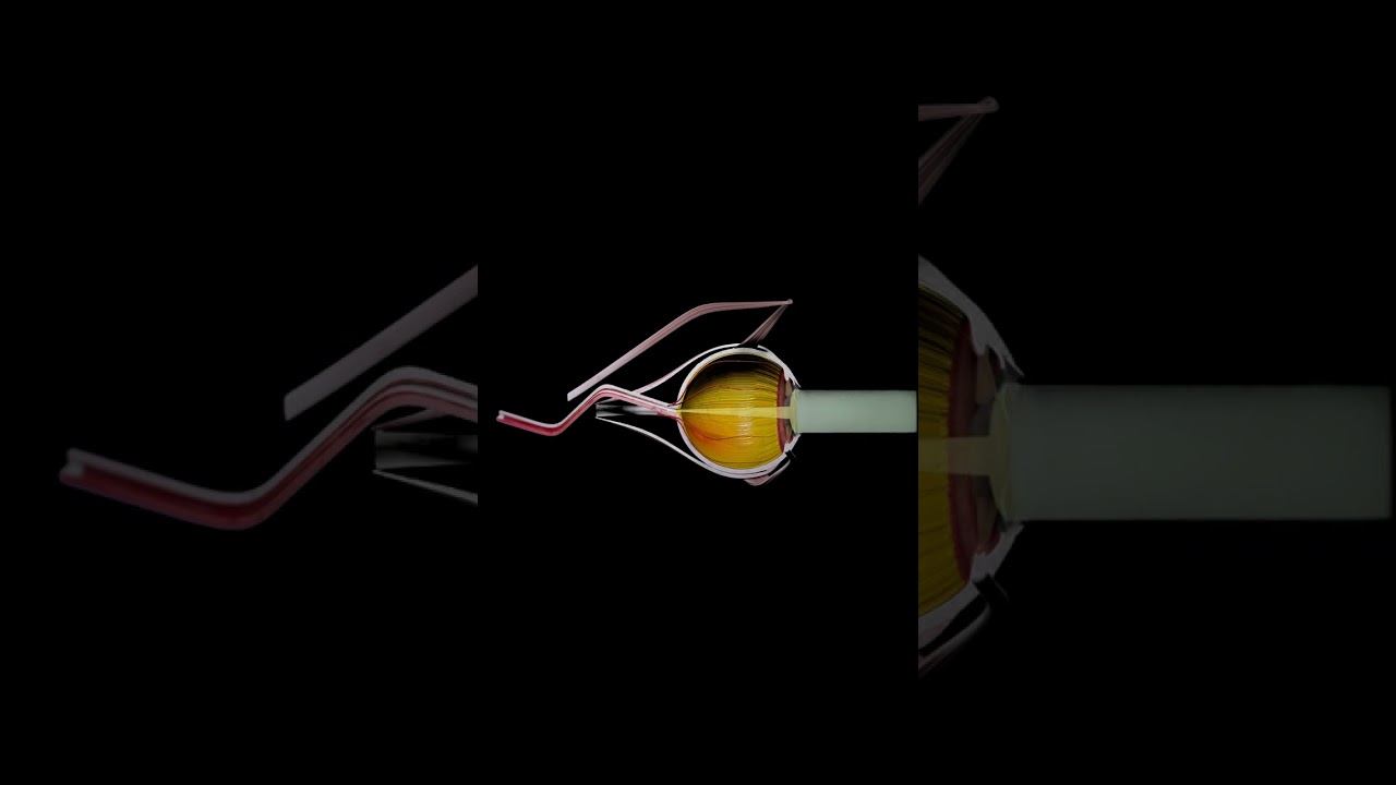 Nearsightedness vs. Farsightedness, and Astigmatism Explained смотреть онлайн