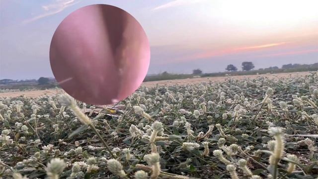 Ear healthy Max # Episode 145 смотреть онлайн