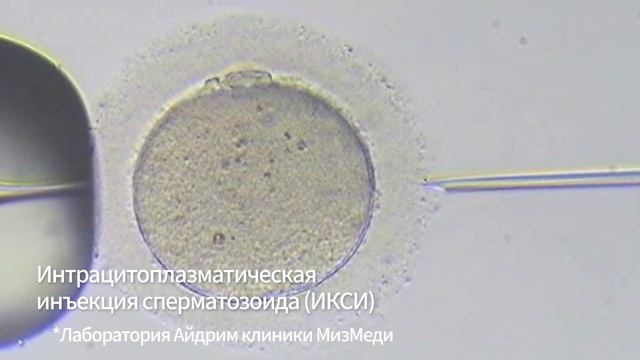 Центр лечения бесплодия "iDream", специализированная женская клиника "МизМеди" смотреть онлайн
