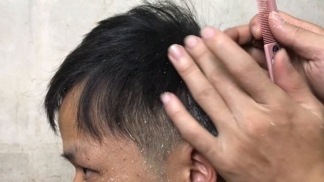 Itchy Scratching ||  Dandruff Removal Off Big Flakes  || ASMR Scratching #101