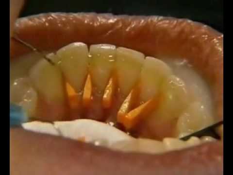 Копия видео "Glas Span" смотреть онлайн